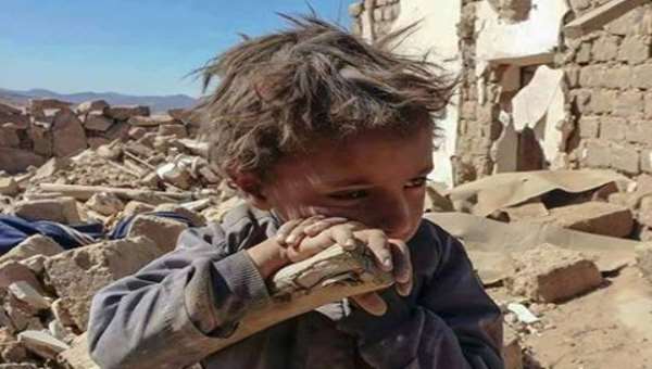 مليشيات الحوثي تتاجر بصور ضحاياها في الخارج