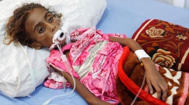 منظمة دولية : اليمن يواجه أكبر أزمة غذائية في العالم