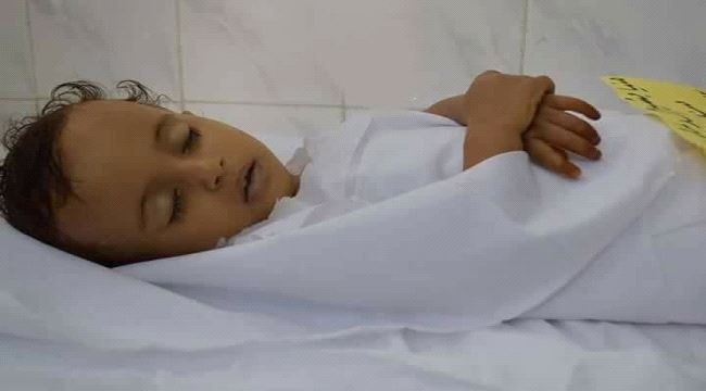 #تعز : رصاصة قناص حوثي تنهي حياة الرضيعة منية( صورة) 