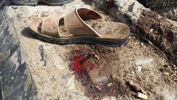 5 جرحى خلال احباط تفجير سيارة مفخخة في بوابة مطار عدن الدولي