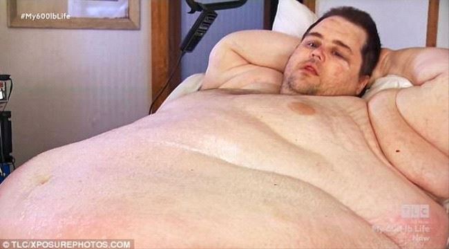 بالصور.. كيف وصل وزن هذا الرجل إلى 380 كيلوغراماً ؟