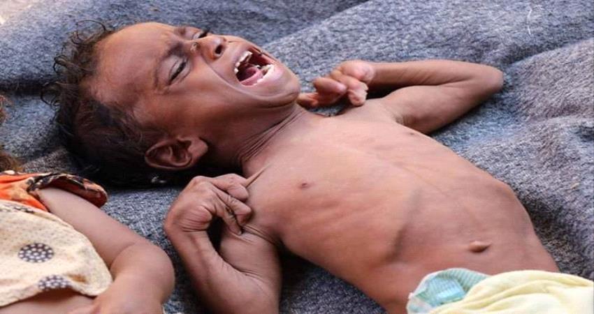 المجاعة تهدد 3700 طفل فيها.. إنطلاق حملة إعلامية واسعة للتعريف بالوضع الإنساني المخيف في مديرية المسيمير بلحج