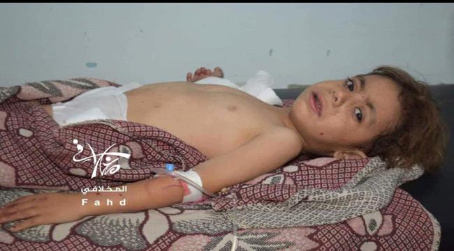#الحـوثيون يرتكبون مجزرة جديدة ضحاياها أطفال في تعز