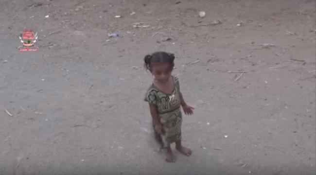 شاهد بالفيديو.. عائله في الدريهمي تعيش مأساة دائمة سببها هاونات المليشيات #الحـوثية 