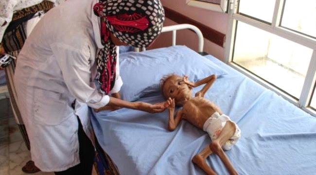 #الأمم_المتحـدة: استمرار حرب اليمن يهدد بأسوأ مجاعة منذ 100 عام وموت 13 مليون شخص جوعا
