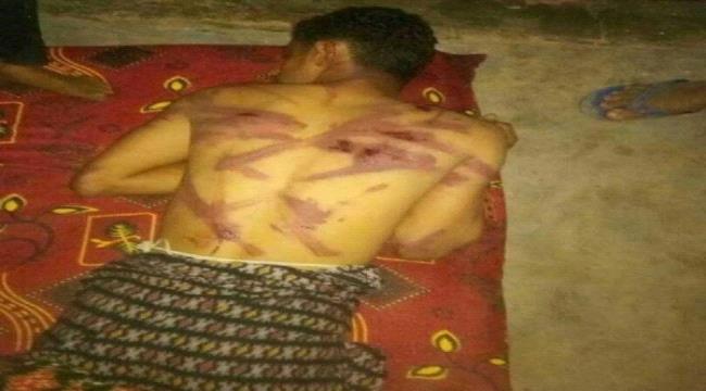 «هيومن رايتس» تتهم #الحـوثيين باحتجاز رهائن وتعذيب معتقلين