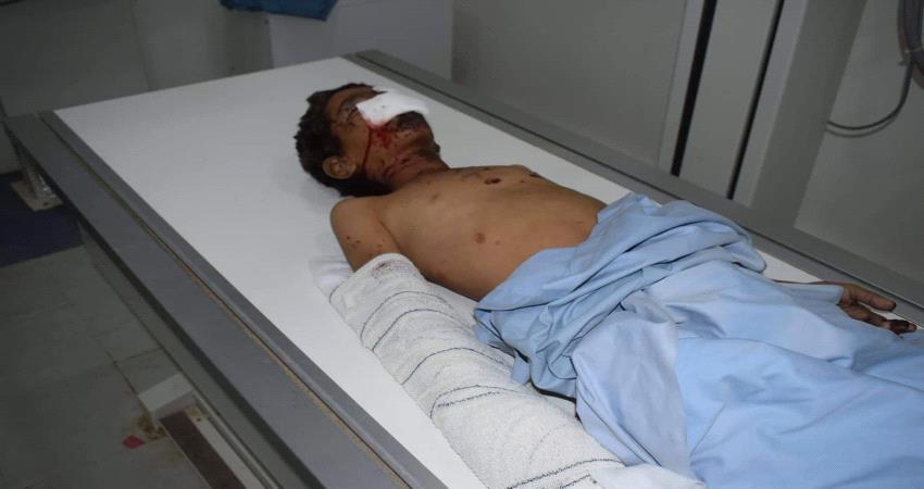 إصابة طفل بشظايا مقذوف حوثي في الجوف