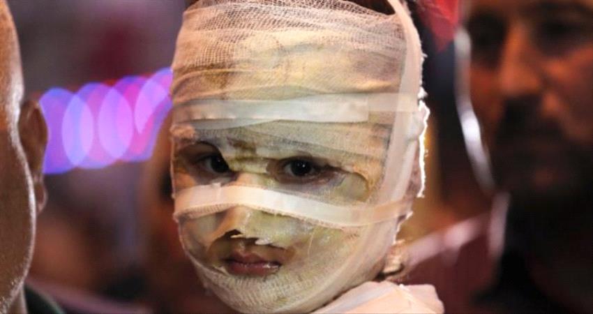 إصابة طفلة بشظايا قذيفة حوثية في الحديدة