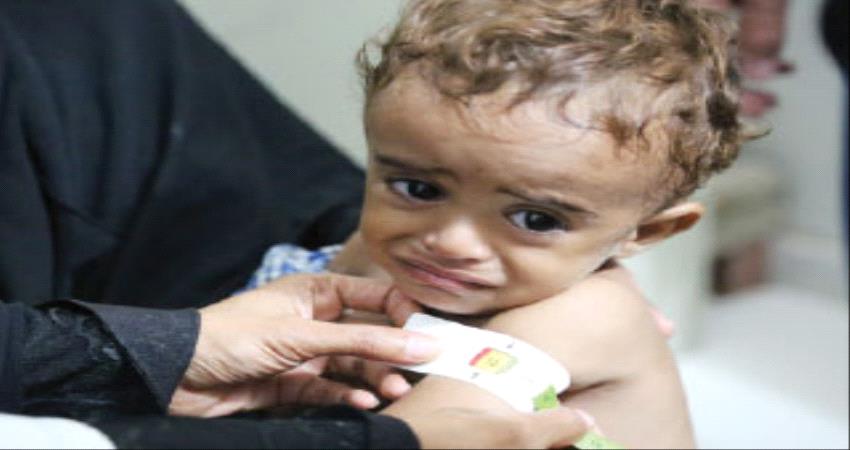 جيل من أطفال اليمن مهدد بالضياع بسبب سوء التغذية