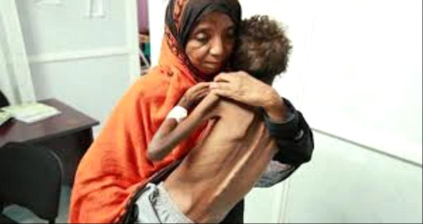 وزير يمني: 12 مليون إنسان مهددون بالمجاعة 