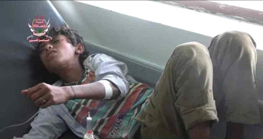 الحديدة .. إصابة طفل بإنفجار لغم زرعته مليشيات #الحـوثي في مديرية حيس