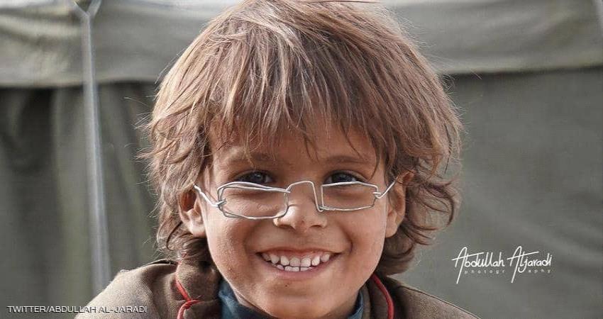 "نظارة" طفل نازح يمني تباع بـ 2.5 مليون ريال