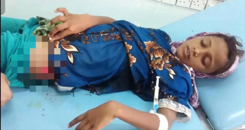 إصابة طفلة بنيران قناصة مليشيا الحوثي جنوبي الحديدة
