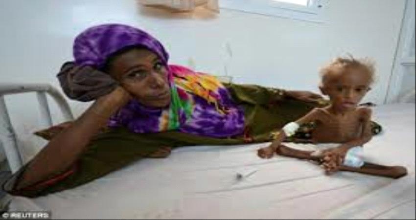 نتيجة حرب الحوثي...اليمنيون على موعد مع "مجاعة كارثية"