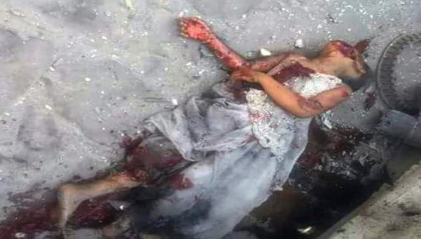 مقتل 3 نساء وإصابة أطفال بقصف حوثي على تعز