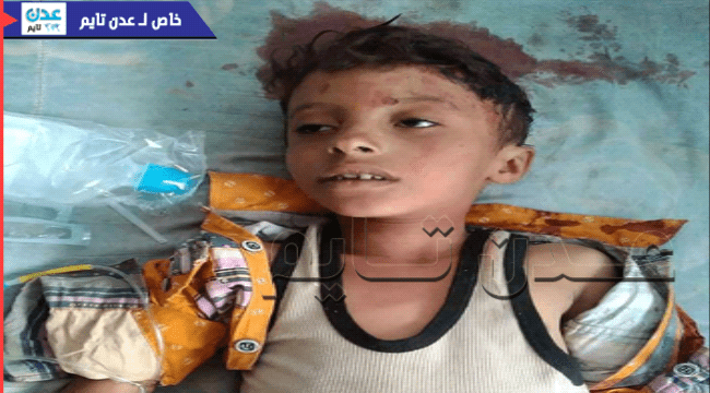 صورة- استشهاد طفل.. وقصف حوثي على طورالباحة شمالي لحج