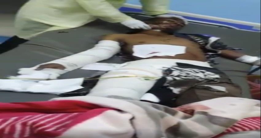 مصرع امرأتان واصابة ثلاثين آخر في حادث مروري بمحافظة الجوف
